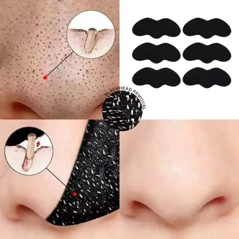 Blackhead Removal Nose Strips – Deep Cleansing & Pore Unclogging
