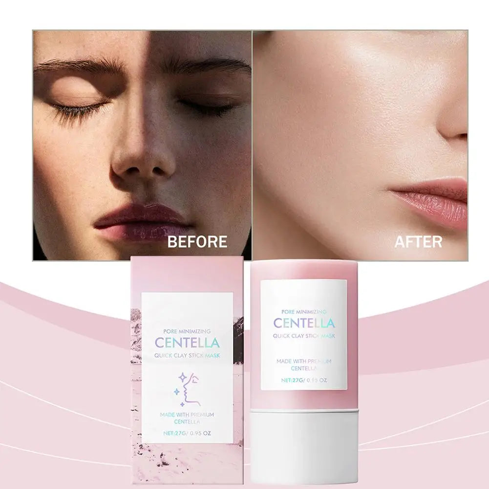 Centella Clay Facial Mask – Deep Hydration & Pore Minimizing