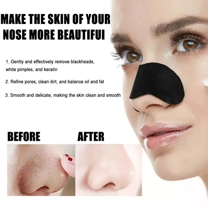 Blackhead Removal Nose Strips – Deep Cleansing & Pore Unclogging